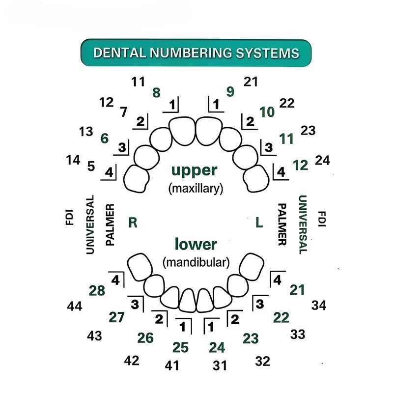 Kit Cetakan Veneer Gigi 32 bua - Teeth Whitening Moulds ulasan dan harga